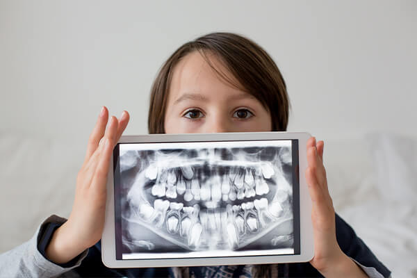 Kid's Dental X-ray | Specialist Orthodontics at 1300SMILES Dentists North Shore